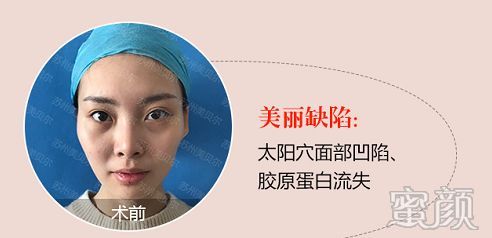 https://img.miyanlife.com/mnt/timg/200109/133T62315-3.jpg