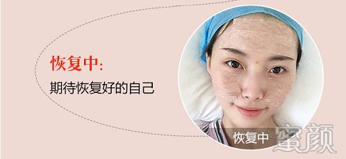 https://img.miyanlife.com/mnt/timg/200109/133TA500-6.jpg