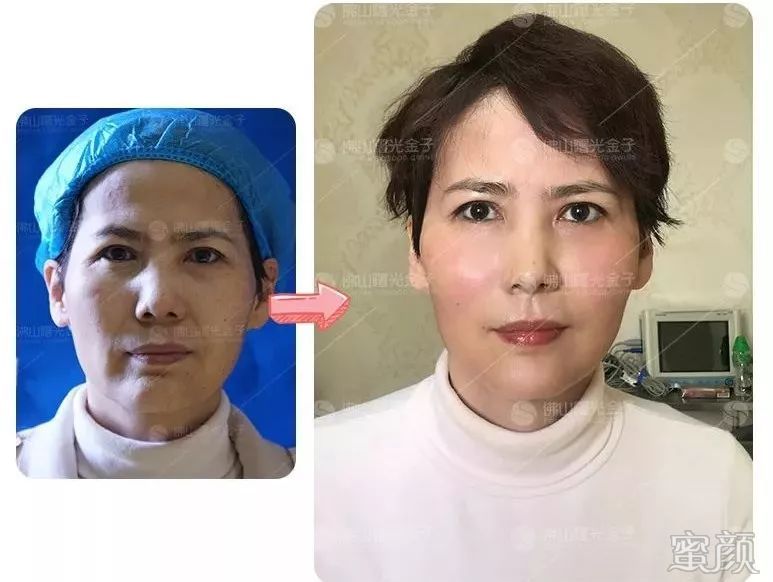 https://img.miyanlife.com/mnt/timg/200109/1343422952-2.jpg