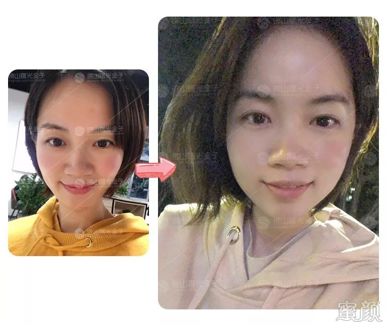 https://img.miyanlife.com/mnt/timg/200109/1343432207-5.jpg