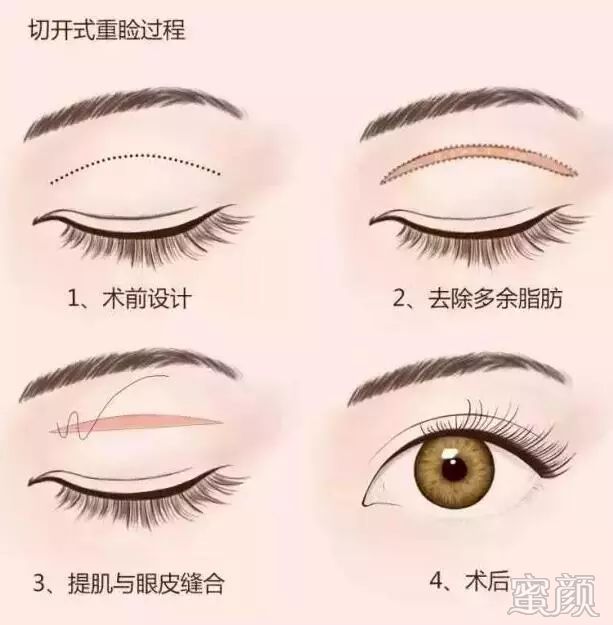 https://img.miyanlife.com/mnt/timg/200109/134411II-2.jpg