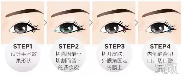 https://img.miyanlife.com/mnt/timg/200109/134411NQ-1.jpg