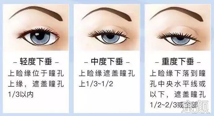 https://img.miyanlife.com/mnt/timg/200109/1344121516-3.jpg