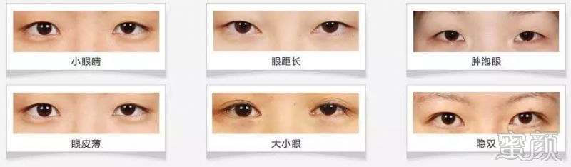 https://img.miyanlife.com/mnt/timg/200109/1354462F3-4.jpg