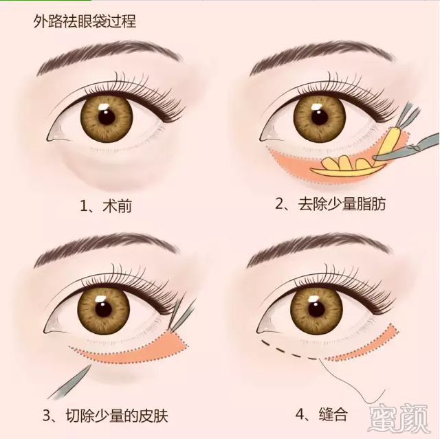 https://img.miyanlife.com/mnt/timg/200109/13544L259-7.jpg