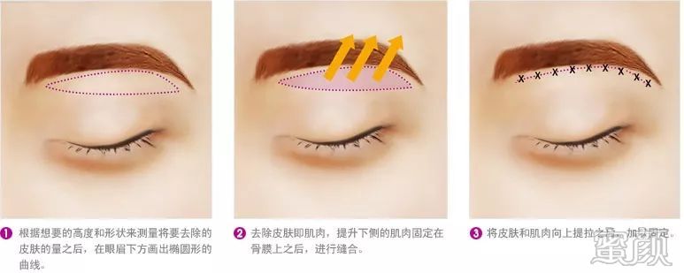 https://img.miyanlife.com/mnt/timg/200109/13544W620-8.jpg