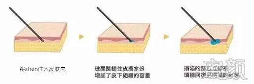 https://img.miyanlife.com/mnt/timg/200109/14563aB8-2.jpg