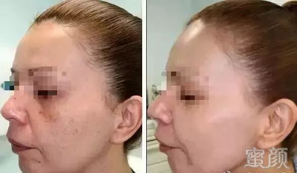 https://img.miyanlife.com/mnt/timg/200109/150Z412c-4.jpg