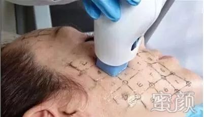 https://img.miyanlife.com/mnt/timg/200109/15122CV9-2.jpg