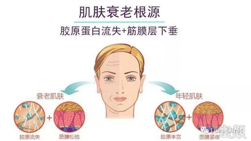 https://img.miyanlife.com/mnt/timg/200109/1513435S0-0.jpg