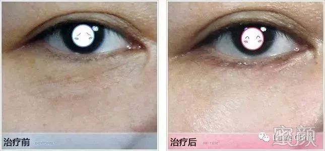 https://img.miyanlife.com/mnt/timg/200109/15134542T-5.jpg