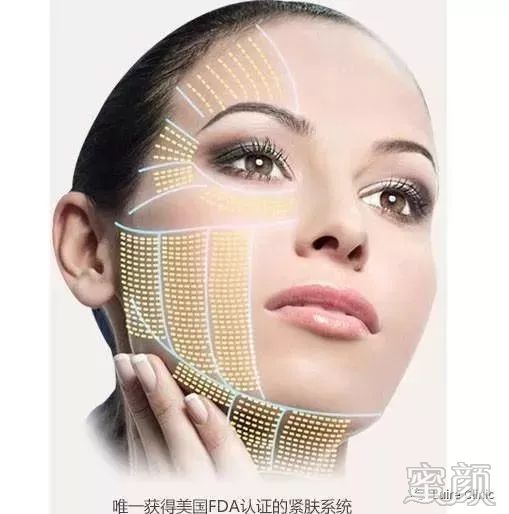 https://img.miyanlife.com/mnt/timg/200109/15134B1R-7.jpg