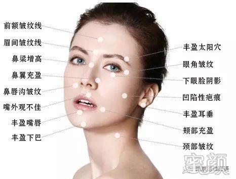 https://img.miyanlife.com/mnt/timg/200109/1515021945-1.jpg