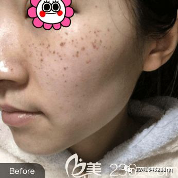 https://img.miyanlife.com/mnt/timg/200109/15245M102-0.jpg