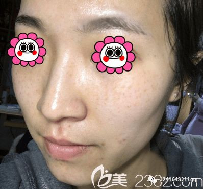 https://img.miyanlife.com/mnt/timg/200109/15245MV5-1.jpg