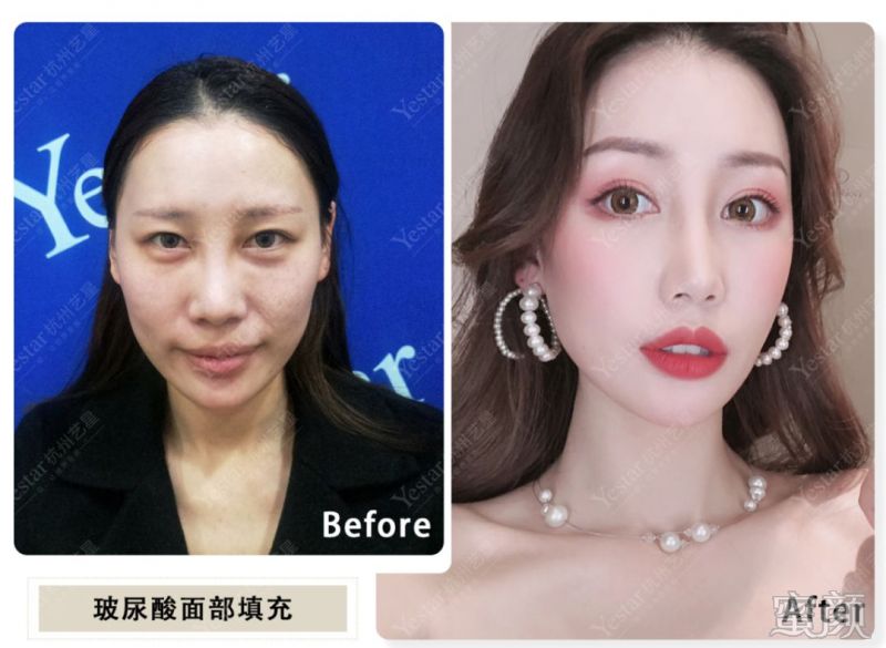 https://img.miyanlife.com/mnt/timg/200109/154H96403-2.jpg