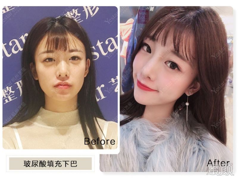 https://img.miyanlife.com/mnt/timg/200109/154I03O1-3.jpg