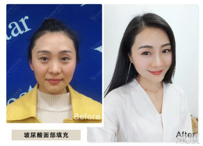 https://img.miyanlife.com/mnt/timg/200109/154I11R7-4.jpg
