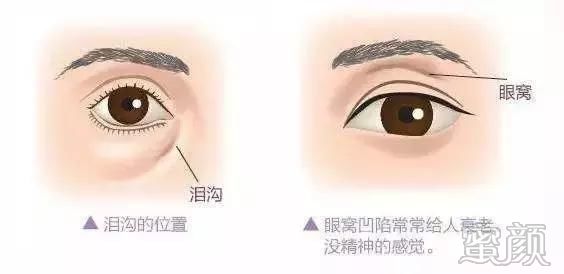 https://img.miyanlife.com/mnt/timg/200109/1619403S3-2.jpg