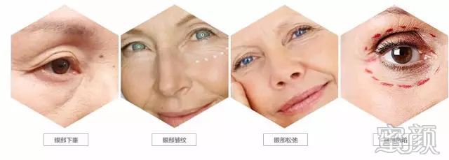 https://img.miyanlife.com/mnt/timg/200109/1619415119-5.jpg