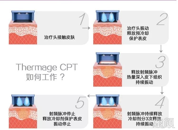 https://img.miyanlife.com/mnt/timg/200110/1043546345-2.jpg