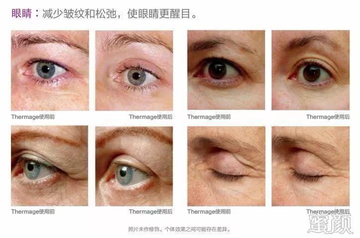 https://img.miyanlife.com/mnt/timg/200110/104355D08-4.jpg
