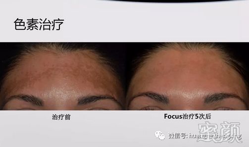 https://img.miyanlife.com/mnt/timg/200110/11143940a-0.jpg