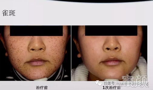 https://img.miyanlife.com/mnt/timg/200110/111440B45-3.jpg