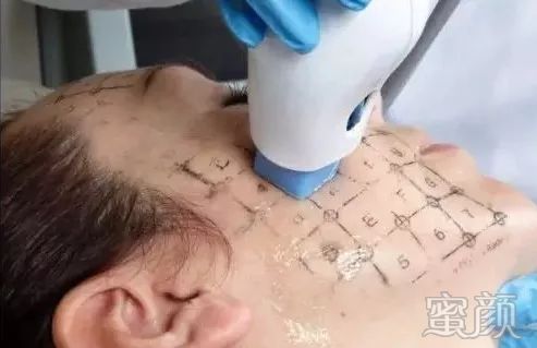 https://img.miyanlife.com/mnt/timg/200110/11241SY5-6.jpg