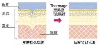 https://img.miyanlife.com/mnt/timg/200110/11241W031-5.jpg