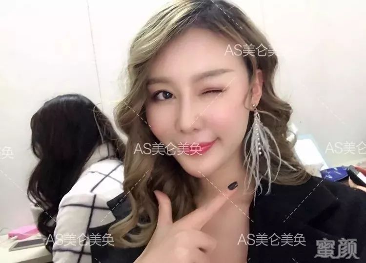 https://img.miyanlife.com/mnt/timg/200110/1602045005-0.jpg