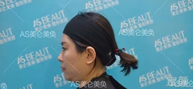 https://img.miyanlife.com/mnt/timg/200110/16020M631-6.jpg