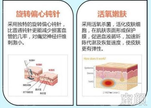 https://img.miyanlife.com/mnt/timg/200111/09253W128-2.jpg