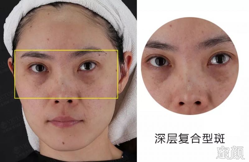 https://img.miyanlife.com/mnt/timg/200111/1150091220-1.jpg