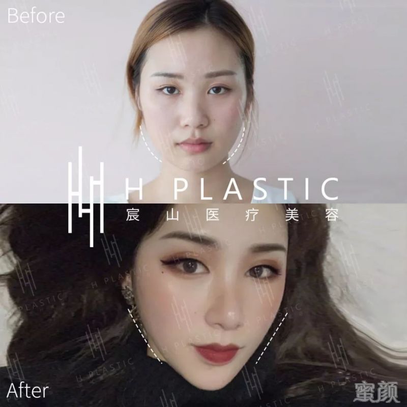 https://img.miyanlife.com/mnt/timg/200112/142I31T1-2.jpg