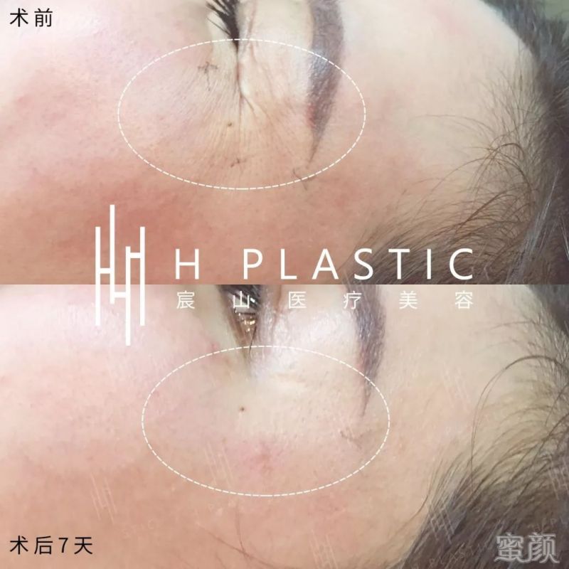 https://img.miyanlife.com/mnt/timg/200112/142IT0U-5.jpg