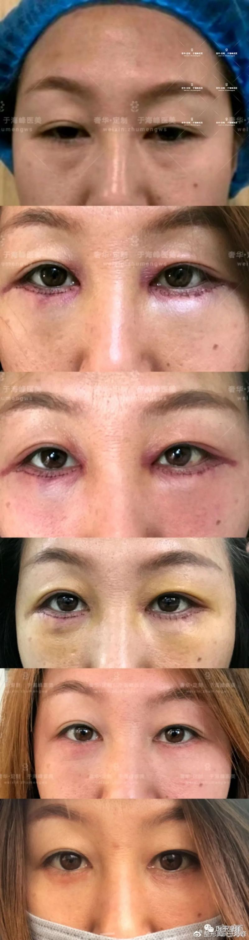 https://img.miyanlife.com/mnt/timg/200112/150F94529-0.jpg