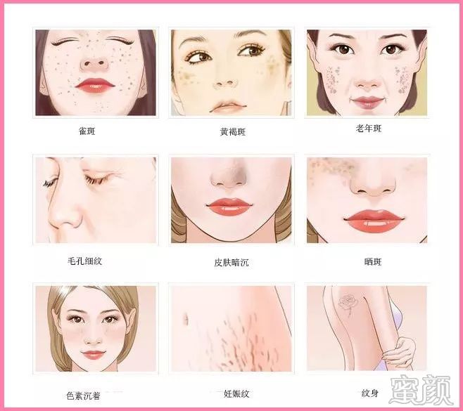 https://img.miyanlife.com/mnt/timg/200113/1125415a7-3.jpg