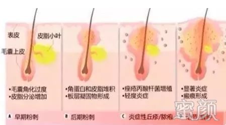 https://img.miyanlife.com/mnt/timg/200113/150945F03-4.jpg