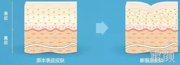 https://img.miyanlife.com/mnt/timg/200113/1509464626-7.jpg