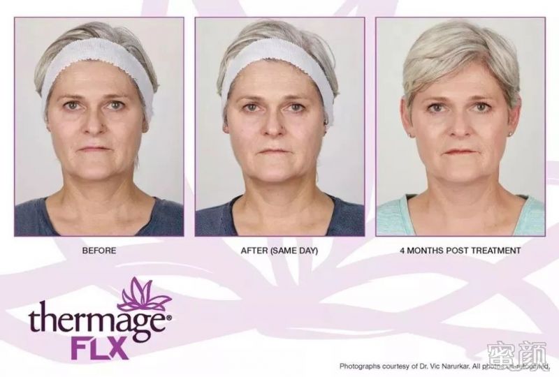 https://img.miyanlife.com/mnt/timg/200114/12094343Y-6.jpg