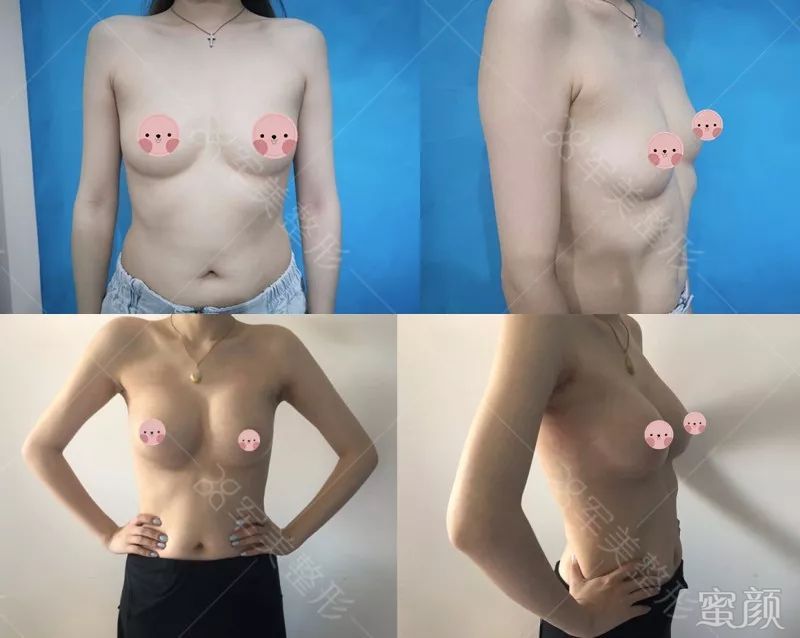 https://img.miyanlife.com/mnt/timg/200114/144910J36-1.jpg