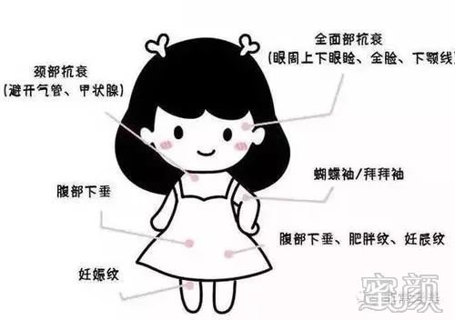 https://img.miyanlife.com/mnt/timg/200115/121JG946-2.jpg