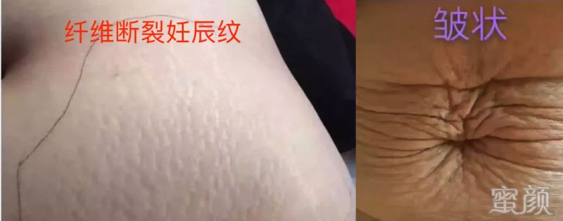 https://img.miyanlife.com/mnt/timg/200115/121JU427-4.jpg