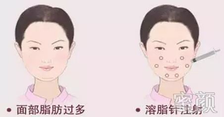 https://img.miyanlife.com/mnt/timg/200115/1923315T3-1.jpg