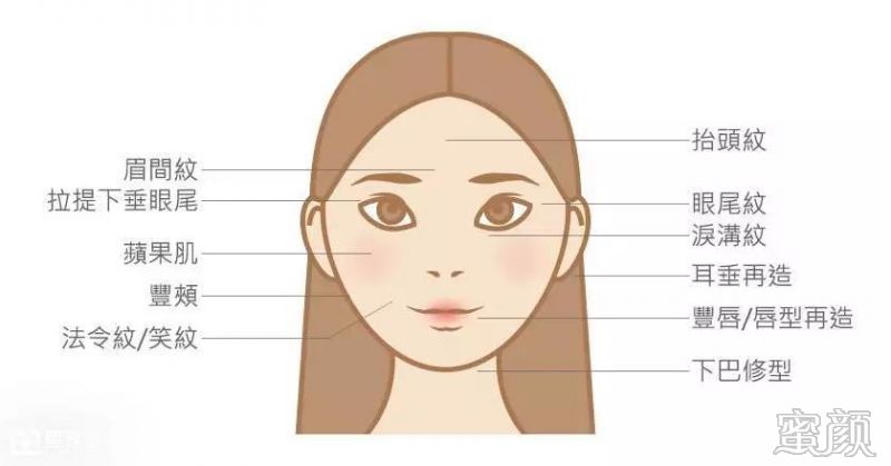 https://img.miyanlife.com/mnt/timg/200115/1925013234-3.jpg