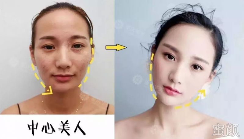 https://img.miyanlife.com/mnt/timg/200115/1925042157-7.jpg