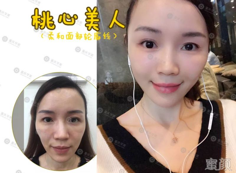 https://img.miyanlife.com/mnt/timg/200115/1925044628-8.jpg