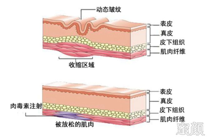 https://img.miyanlife.com/mnt/timg/200115/192KWc2-4.jpg