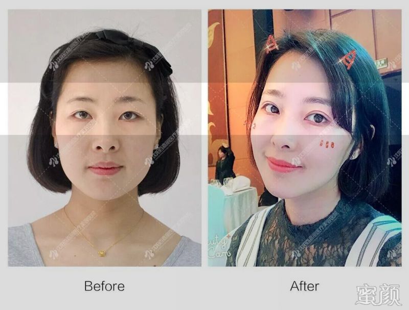https://img.miyanlife.com/mnt/timg/200115/1F1331596-10.jpg